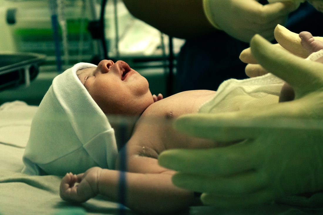 Premature en neonatologie